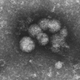 Microscopic image of the hepatitis C viral particles.